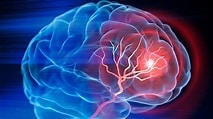 Conférence de sensibilisation AVC